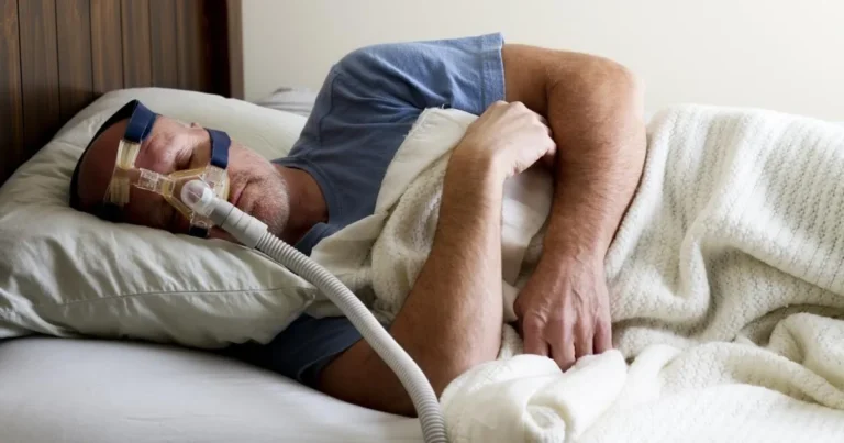 Nuevo medicamento oral contra la apnea del sueño muestra resultados prometedores en ensayo clínico